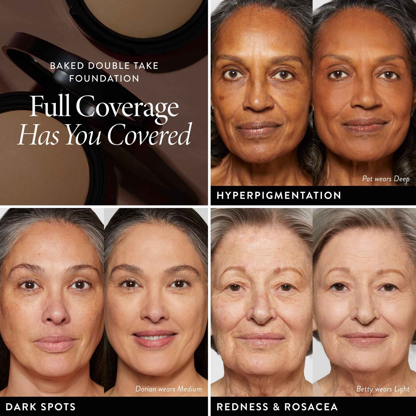 The Dark Spot Solution Kit – Full Coverage